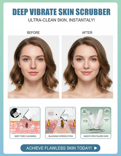 Ultrasonic Skin Deep Pore Vibrating Blackhead Scrubber