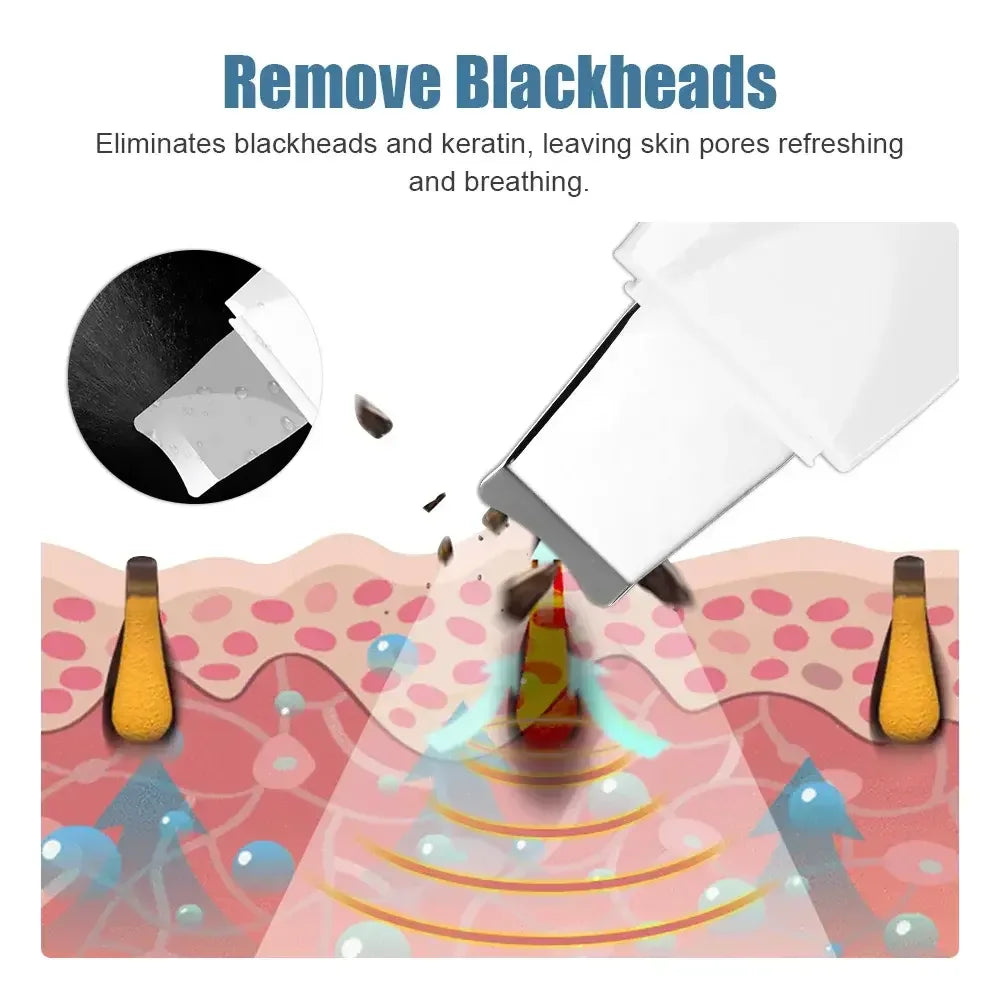 Ultrasonic Skin Deep Pore Vibrating Blackhead Scrubber
