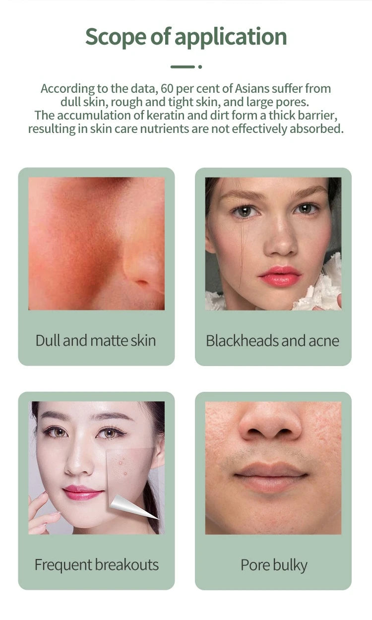 Ultrasonic Skin Deep Pore Vibrating Blackhead Scrubber