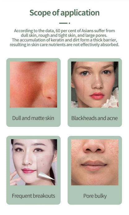 Ultrasonic Skin Deep Pore Vibrating Blackhead Scrubber