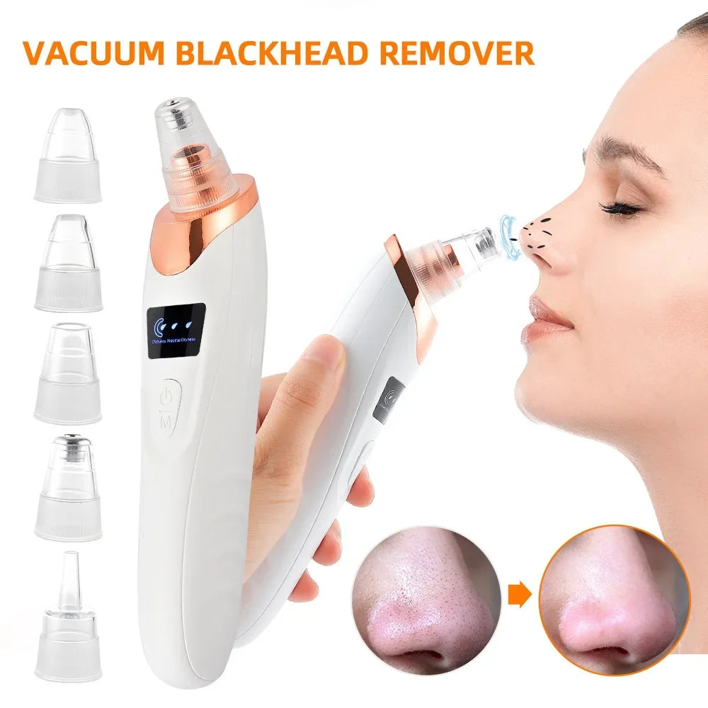 Electric Blackhead Remover - Vacuum Suction Cleaner