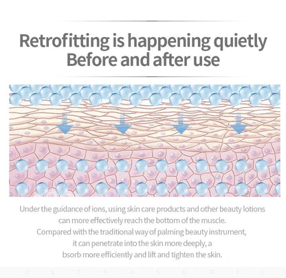 Ultrasonic Skin Deep Pore Vibrating Blackhead Scrubber