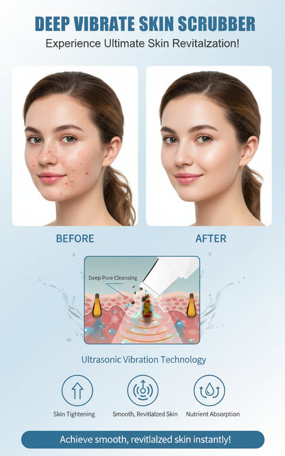 Ultrasonic Skin Deep Pore Vibrating Blackhead Scrubber